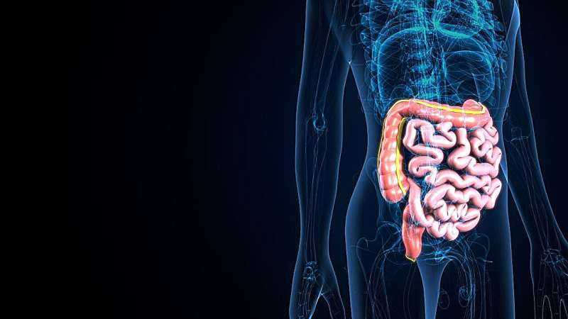 Recommendations developed for assessing postoperative Crohn disease recurrence
