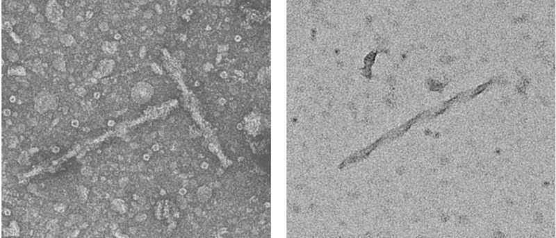 Scientists Uncover How Alzheimer's May Quietly Begin Years Before Memory Loss Appears
