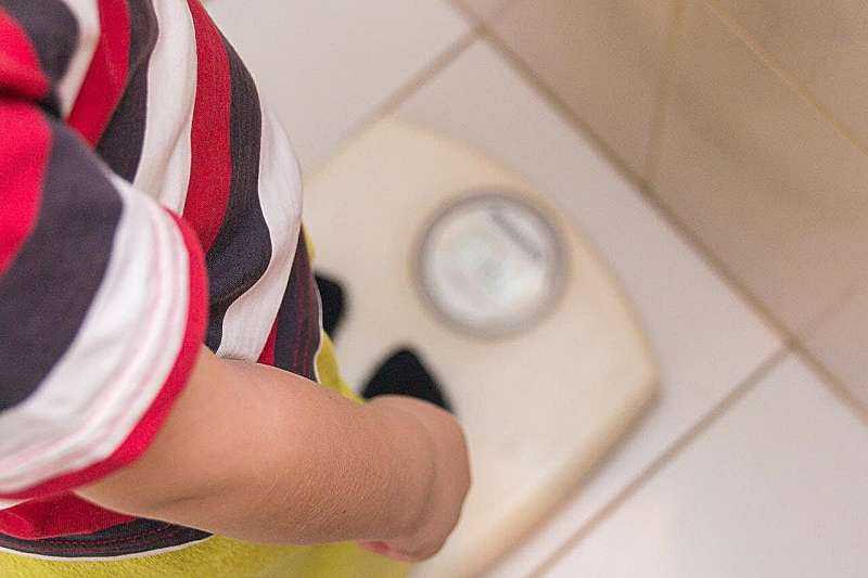 Obesity Linked to Extended Surgery Time in Pediatric Adenotonsillectomies