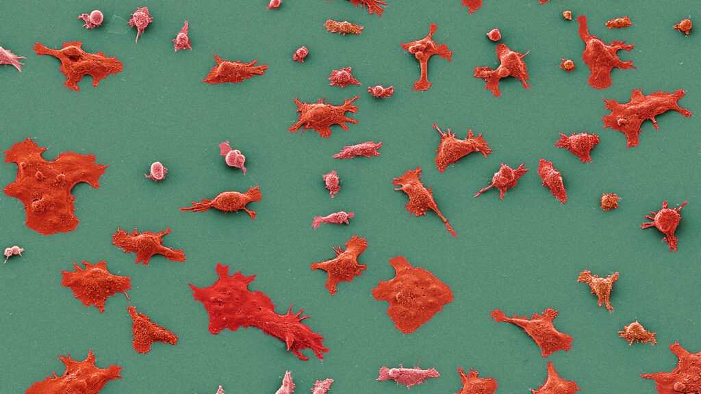 Practice-Changing Results Reported for Revolution Medicines Pancreatic Cancer Drug