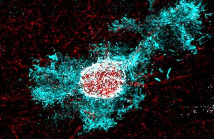 How stress hormone shapes brain development: New clues to why early plasticity fades with age in humans and animals