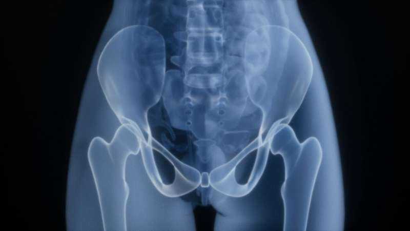 PSMA PET Imaging Outperforms Standard Techniques in Detecting Bone Metastases