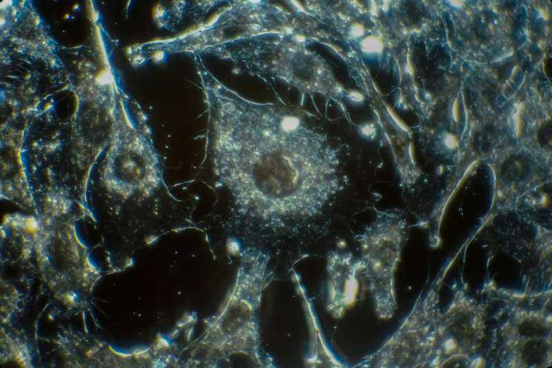 Comprehensive Atlas Maps Dendritic Cells Across Cancers