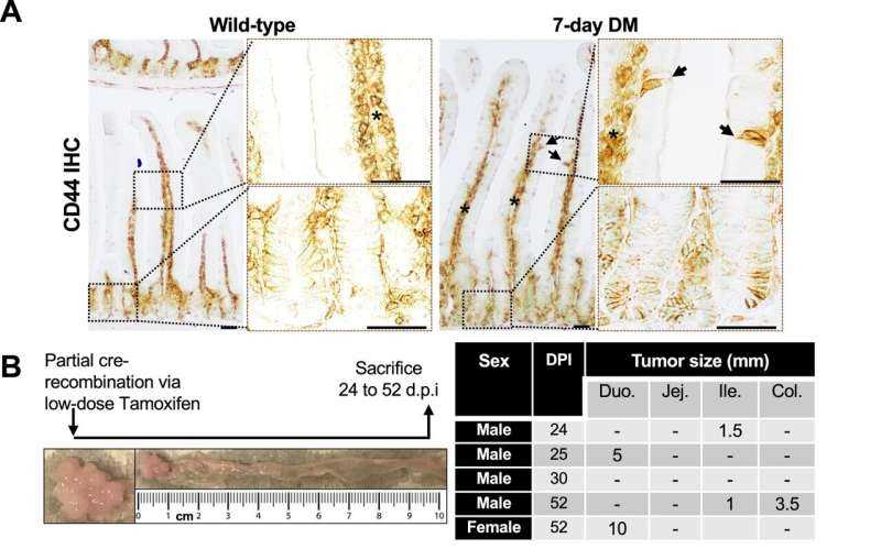 Colorectal cancer has a backup plan, and it begins when mature gut cells regain stem-like traits