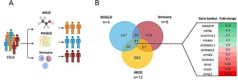 Different Liver Diseases Linked to Unique Patterns of Muscle Loss