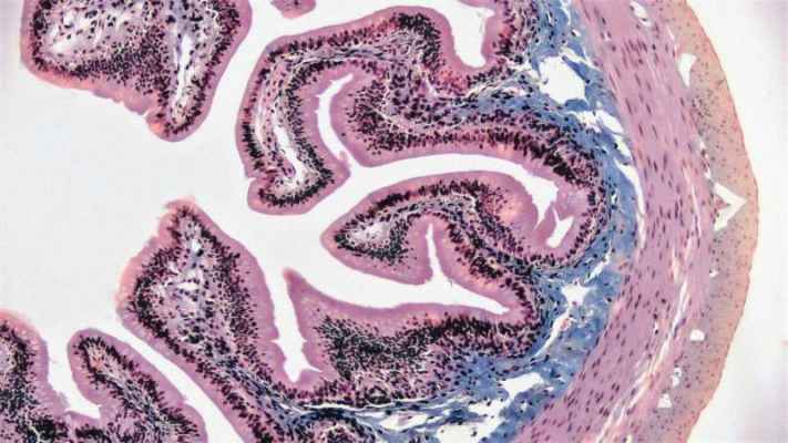 2.2 Million-Cell Atlas Reveals Genetic Drivers of Inflammatory Bowel Disease