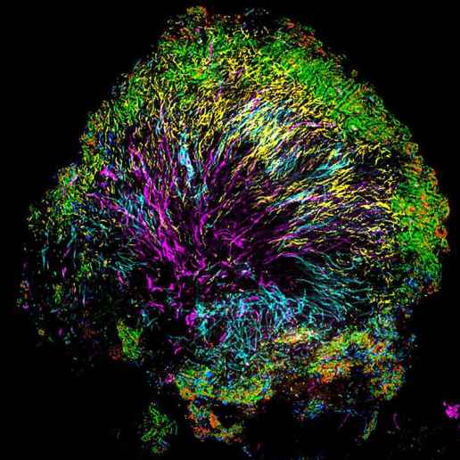The road to better health requires a map of the microbes in your mouth