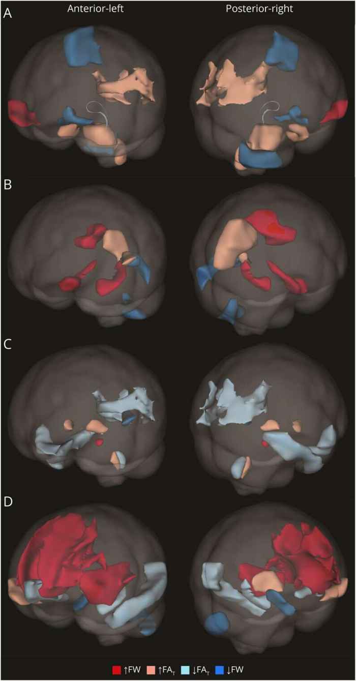 Researchers Develop AI Tool to Enhance Dementia Diagnosis Amid Rising Cases
