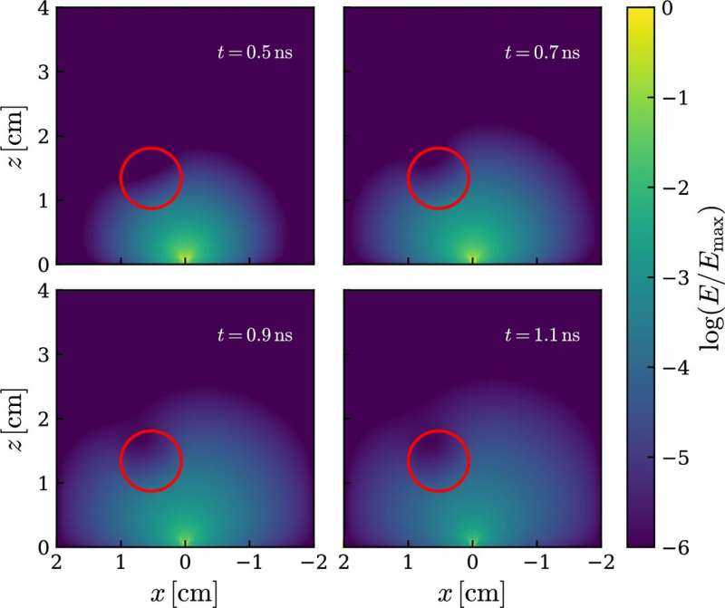 AI model enables more than a million-fold acceleration of diffuse optical tomography for real-time diagnosis