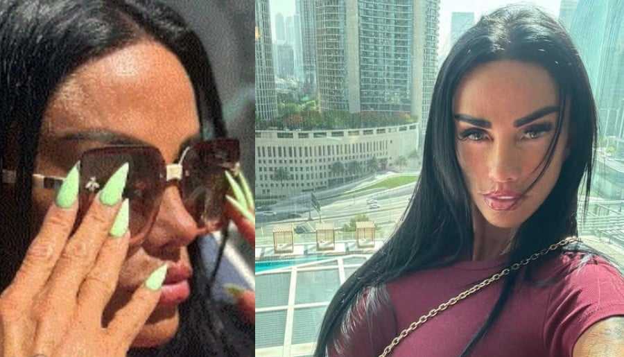 Katie Price Reveals Stress Takes Physical Toll Amid Divorce Realisation