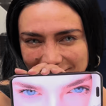 Keratopigmentation: The Costly Surgery That Permanently Changes Your Eye Color