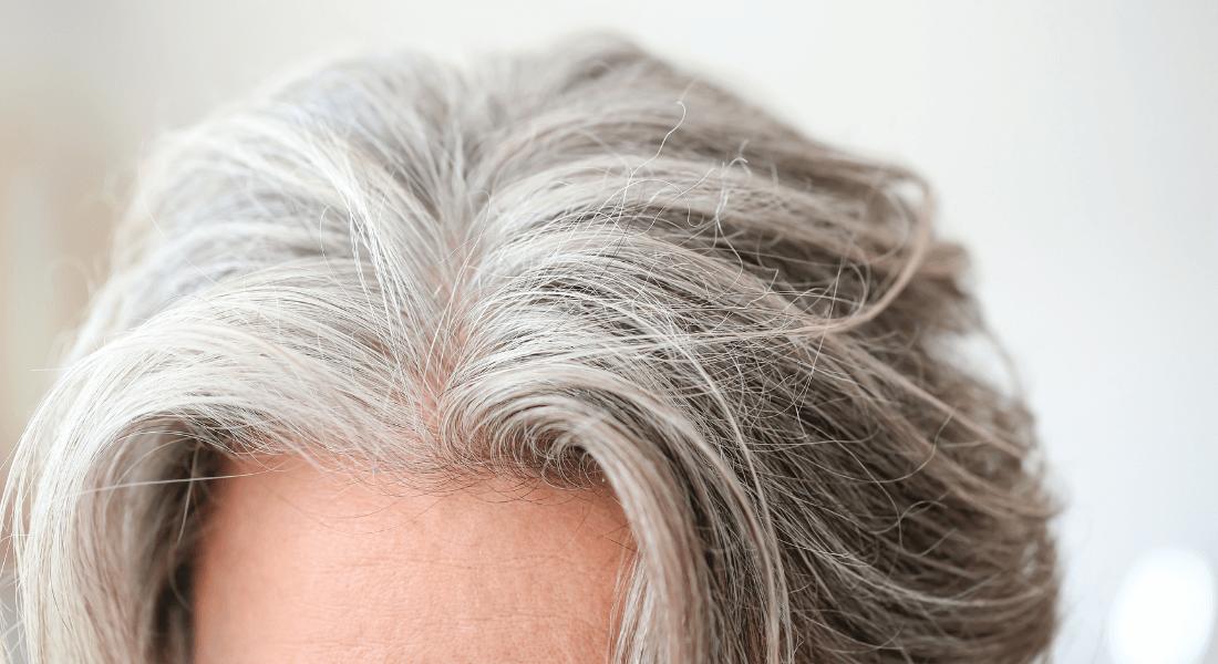 Hormonal Treatments: A New Frontier in Combating Wrinkles and Gray Hair