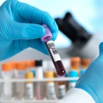 Insulin Resistance Identified as Early Predictor of Alzheimer’s and Brain Decline
