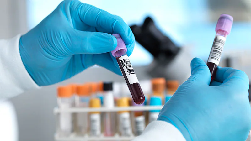 Insulin Resistance Identified as Early Predictor of Alzheimer’s and Brain Decline
