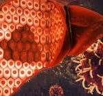 Liver Cancer Cases to Nearly Double by 2050, but Most Are Preventable