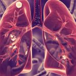 New Lung-Targeted TB Vaccine Research Unlocks Promise of Superior Immune Protection