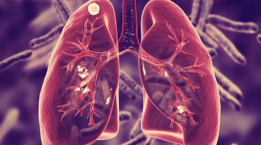 New Lung-Targeted TB Vaccine Research Unlocks Promise of Superior Immune Protection
