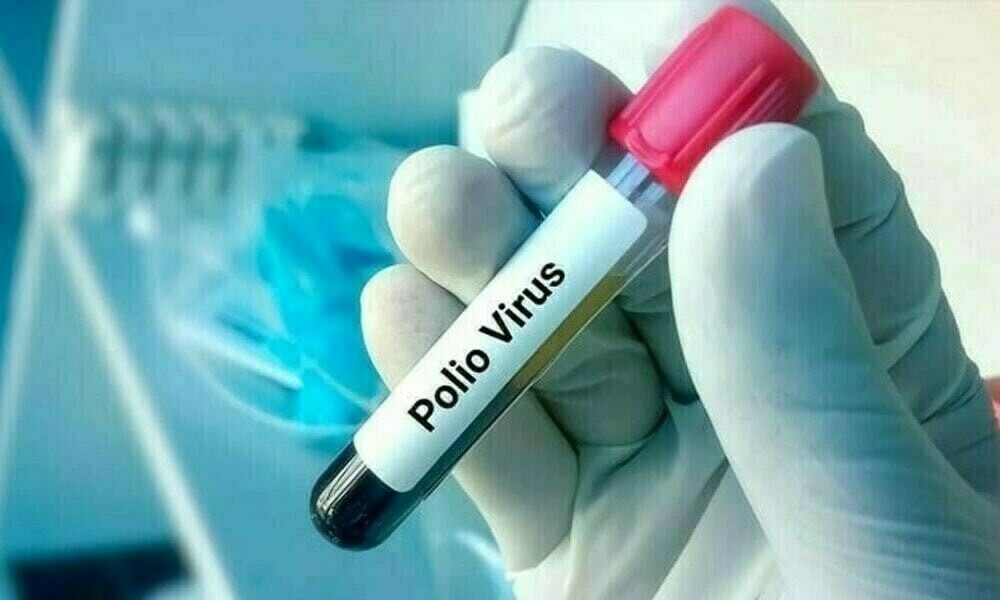 NIH Reports Three New Polio Cases in Pakistan; National Tally Hits 17 in 2025