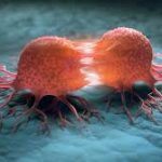 UAE’s Rising Cancer Burden Sparks Alarms Over Healthcare System Capacity and Readiness