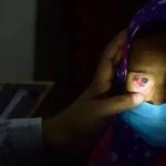 Conjunctivitis Outbreak in Malakand: Batkhela Reports Over 1,600 Cases