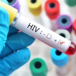 Aesthetic Clinics Under the Microscope as HIV Crisis Escalates in Pakistan