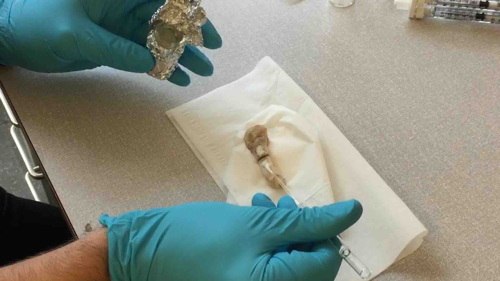 Revolutionary Bone-02 Glue Can Heal Broken Bones in Just Three Minutes