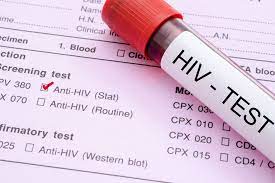 Pakistan Faces Alarming Surge in HIV Cases in 2025