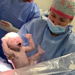 C-Section Deliveries in Pakistan Surge Beyond Safe Limits